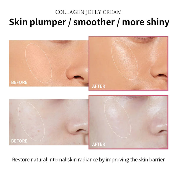 Anti-Aging-Collagen-Face-Cream-100ml-Niacinamide-Moisturizer-Hydrating-Gel-For-Tightening-Soothing-Firmness-Skincare.png